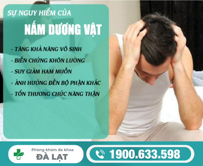 Hình ảnh minh họa